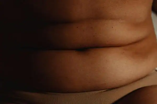 The Hidden Connection: How Stress Shapes Your Fitness and Body Composition 3 image of what stress can do on the stomach area and how Lipo 360 Maidenhead can help to change your body shape.
